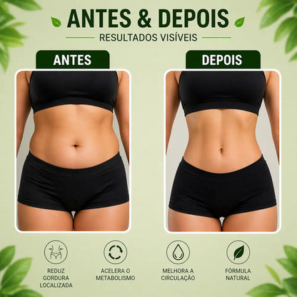 resultado antes e depois de uso de creme anti celulite corporal